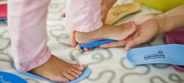 The base has the Valgus deformation of the foot in children