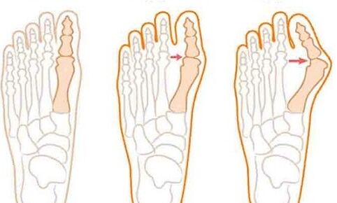 Foot development