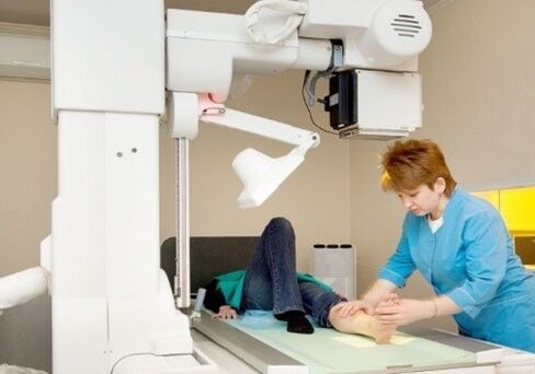 Foot x -ray
