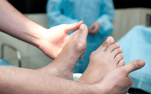 Deforming Valgus of the foot